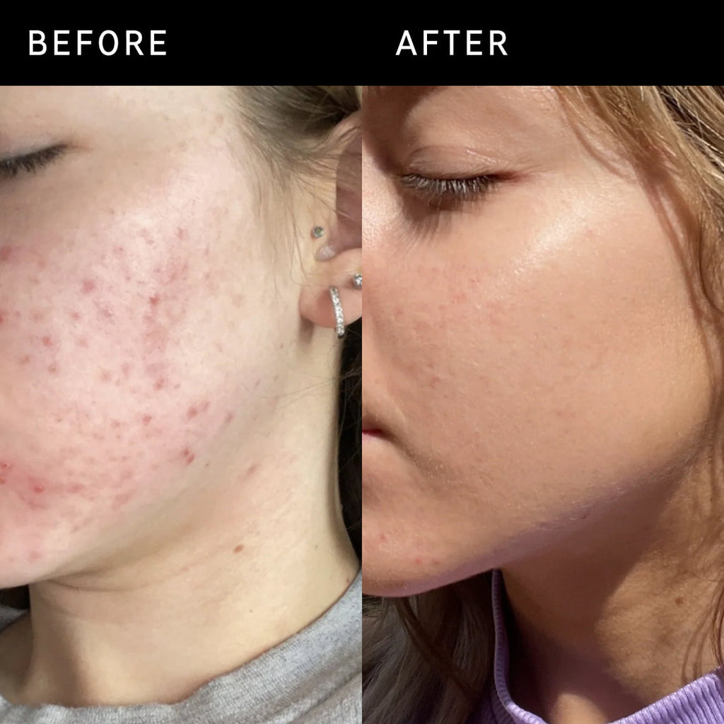 The inkey list Niacinamide serum